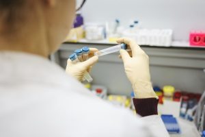testy na covid kosztem w działalności